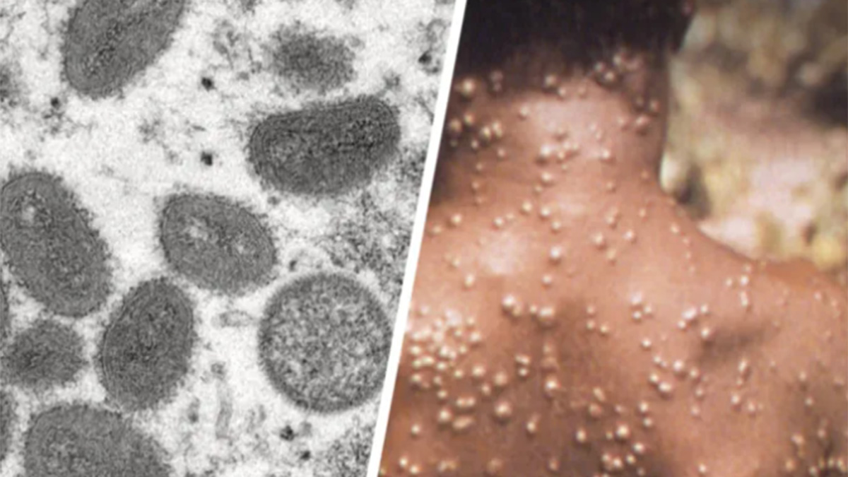 Un 4e cas de la variole du singe en Belgique: l'ampleur de l'épidémie devient "de plus en plus claire"", réagit Marc Van Ranst