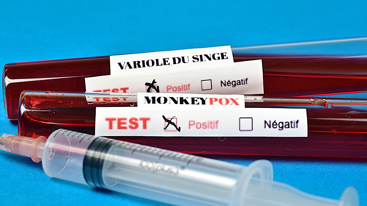 Monkeypox: la vaccinazione si estende a MSM